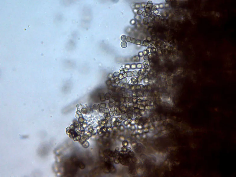 Coremiella cubispora 1 - Superficie adulto agua x 400